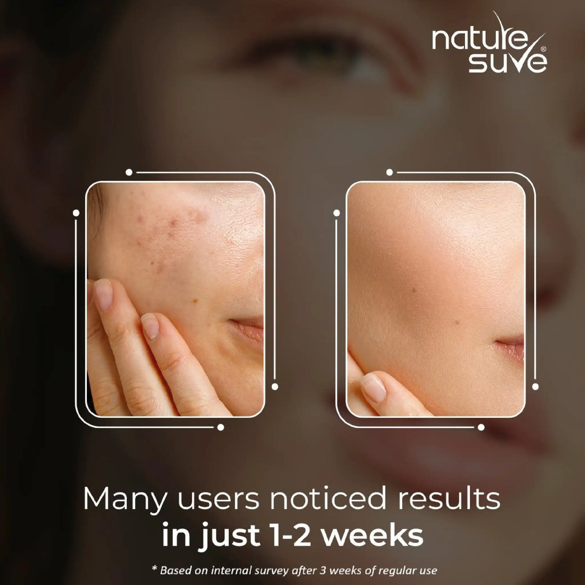 Nature Sure Pores and Marks Face Oil – Visible Results Noticed by Most Users in 1-2 Weeks