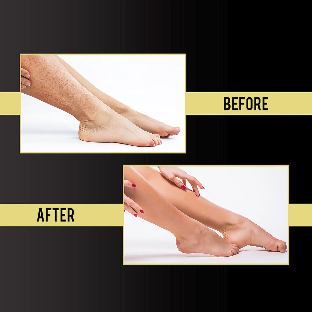 NEUD After-Hair-Removal Skin Lotion - Say Goodbye to Dry Skin, Chapped Skin, Dull Skin, And Cracked Heels